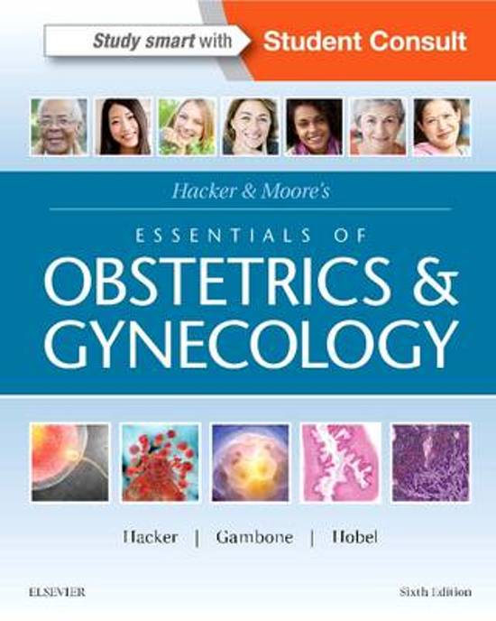Test Bank For Hacker & Moore's Essentials of Obstetrics and Gynecology 6th Edition By Neville F. Hacker, Joseph C. Gambone, Calvin J. Hobel 9781455775583 Chapter 1-42 Complete Guide .