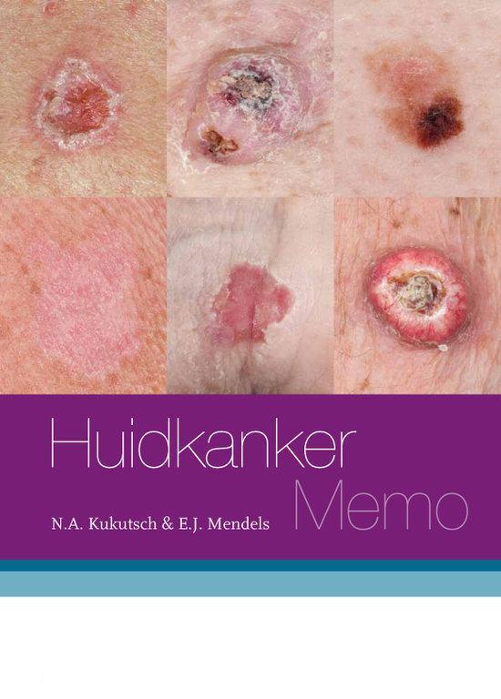 Samenvatting Benigne & (pre)maligne huidafwijkingen - Huidkanker Memo
