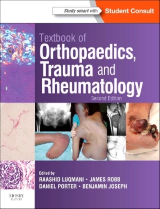 Textbook of Orthopaedics, Trauma and Rheumatology