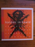 Paula Vos boek Kanker in Beeld Paperback 9,2E+15